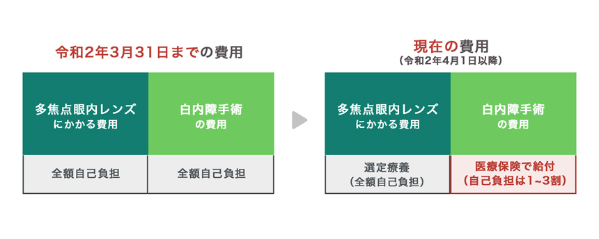 表：多焦点眼内レンズを用いた白内障手術の費用。選定費用により自己負担額が軽減されます。