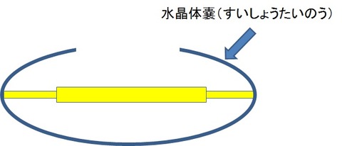 水晶体のう