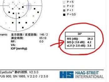 3　MD1