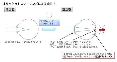 図4