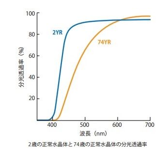 白内障とcolorの見え方１