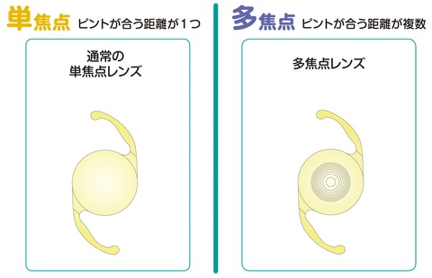 レンズの種類