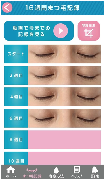 グラッシュビスタ4